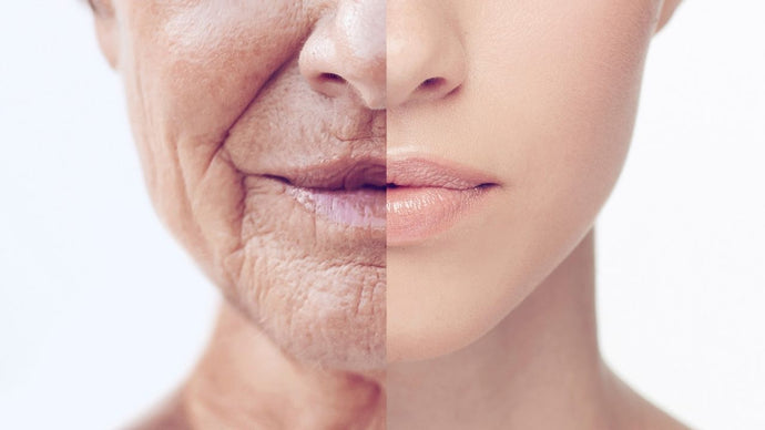 ¿Qué es el fotoenvejecimiento y cómo se puede prevenir?