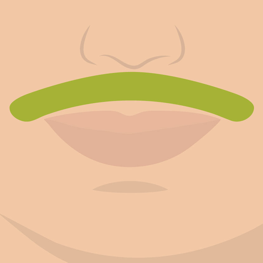 depilacion laser de bigote puerto rico